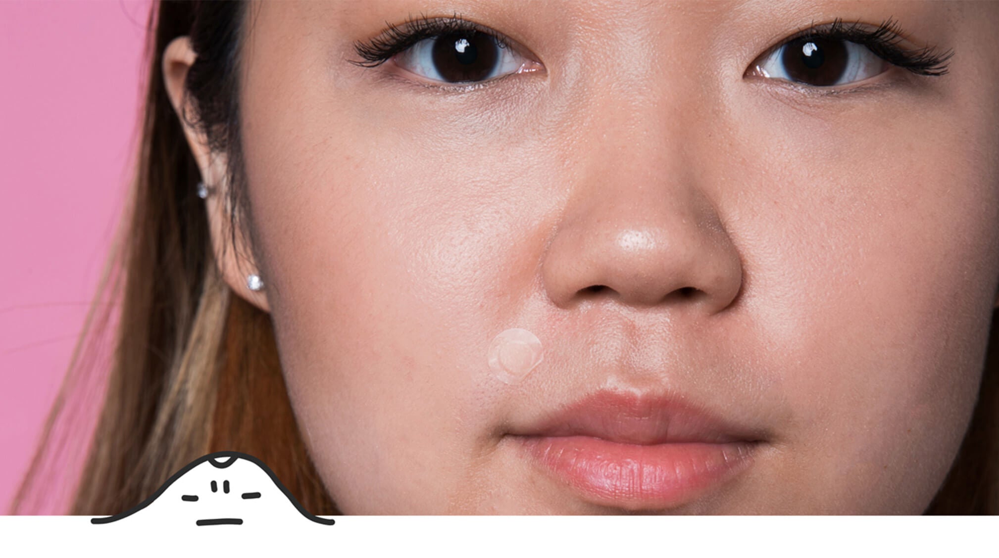 Asian girl with Mighty Patch Invisible+ on upper lip area