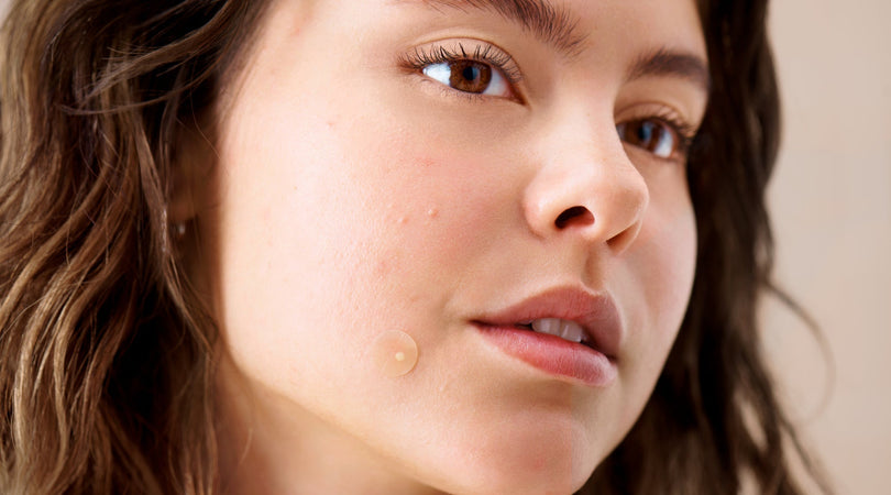 Female wears pimple patch on cheek.
