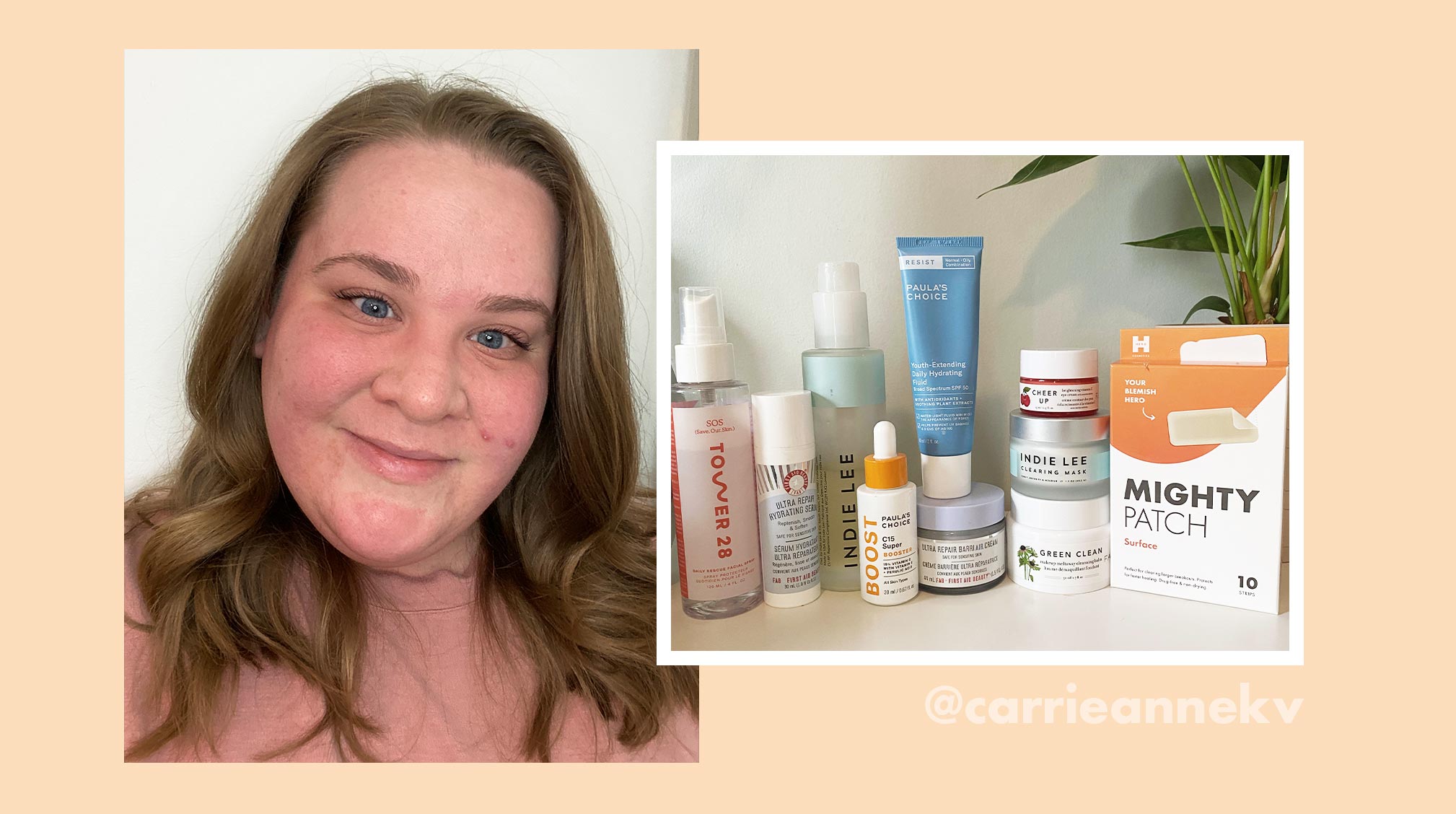 What PCOS Taught Beauty Influencer Carrie Anne About Self-Care