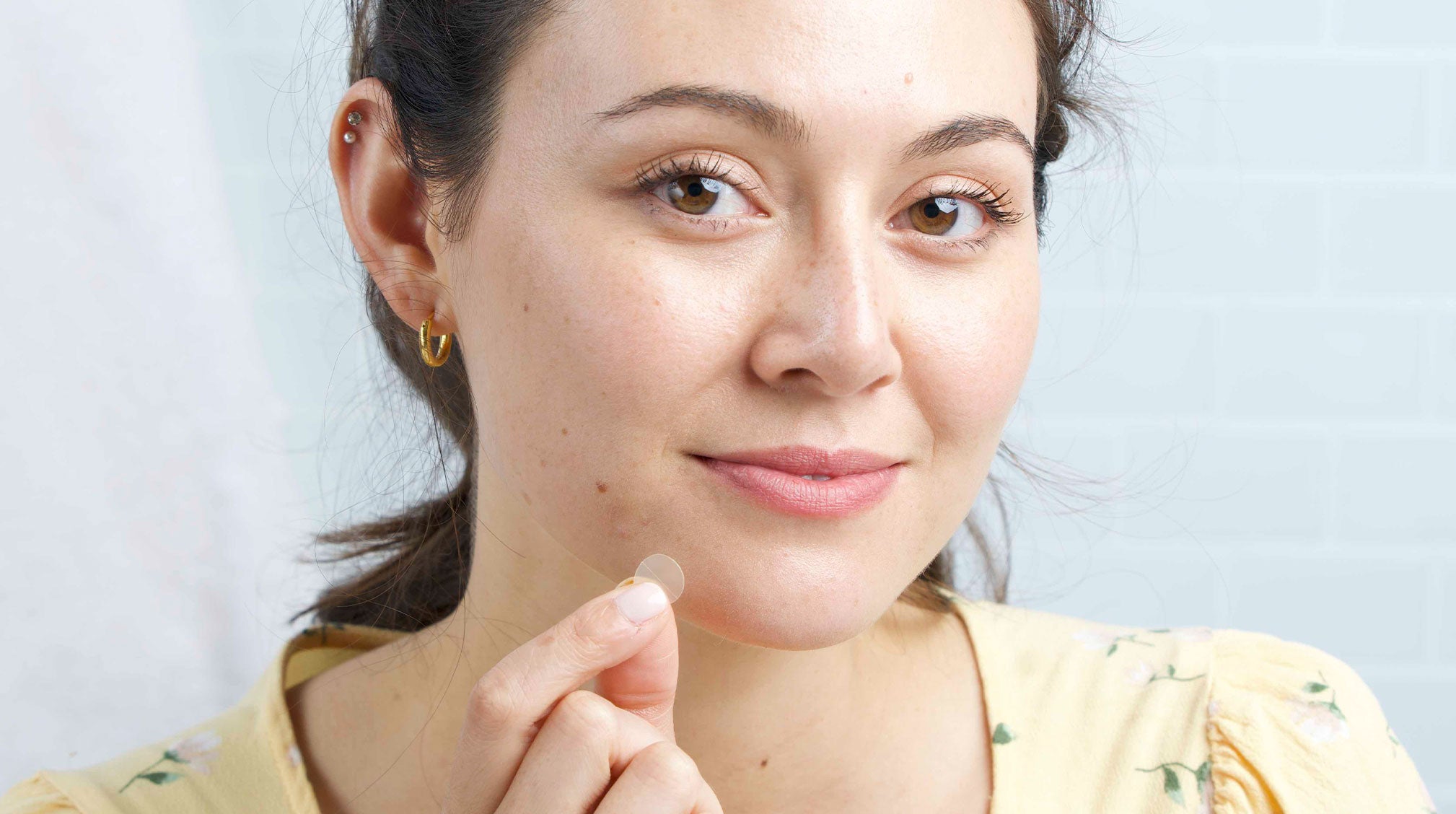 Cleaning Up Acne Prone Skin