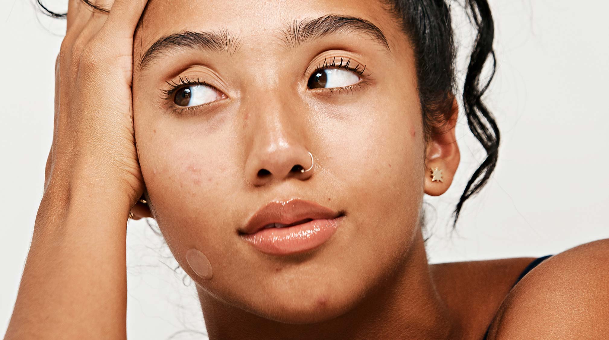 How to Get Rid of a Pimple Overnight