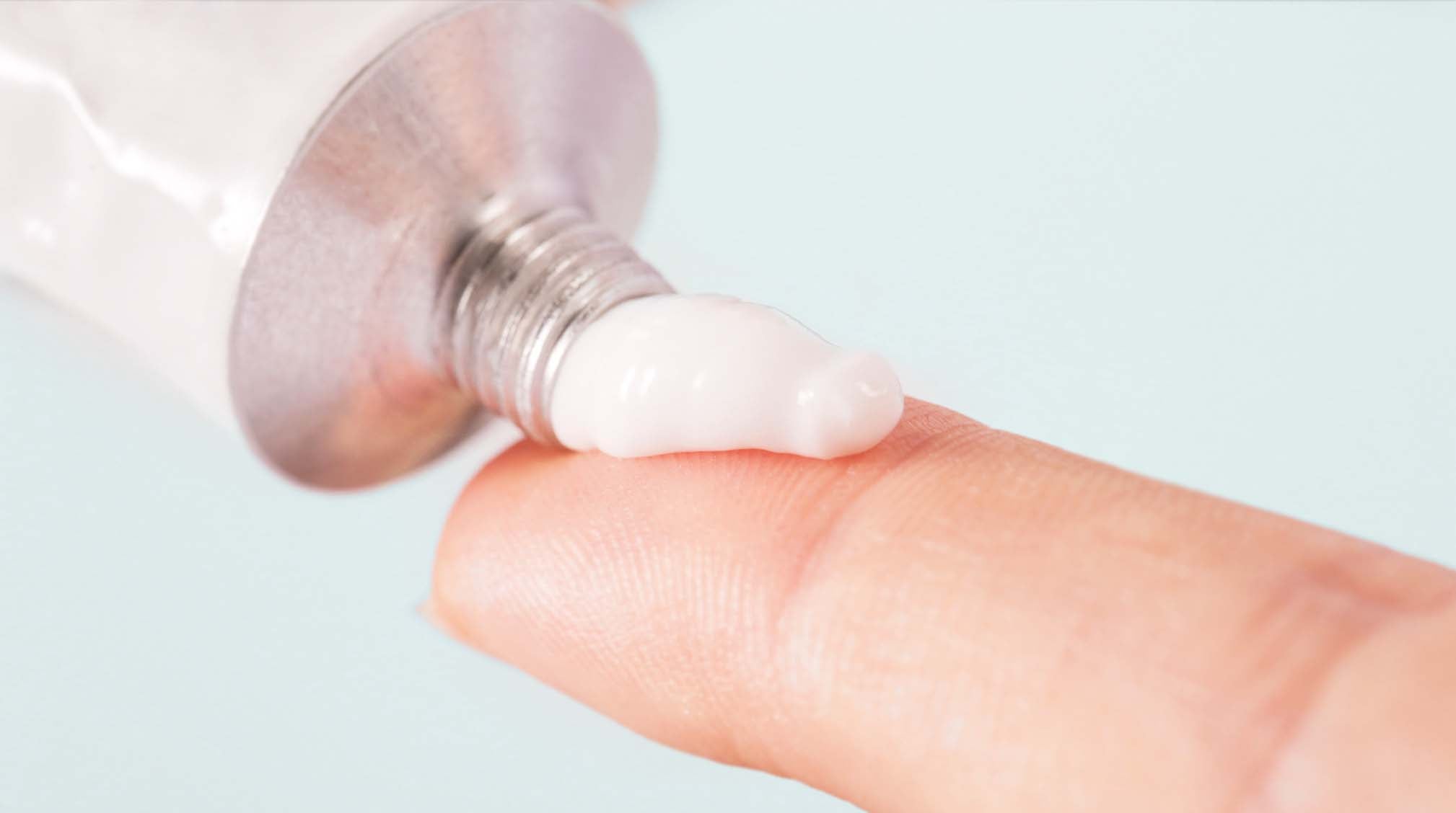 hand squeezing hydrocortisone cream on finger to be used for acne