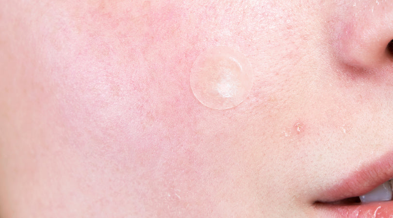 Itchy, reddened, irritated skin