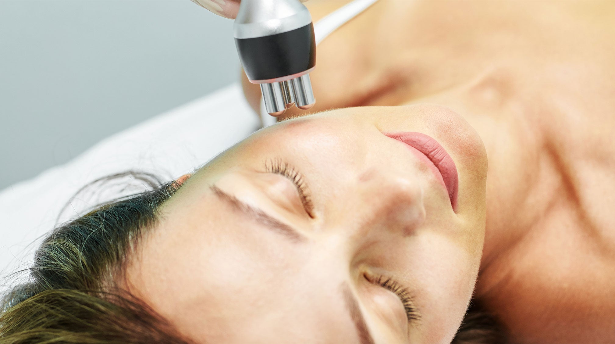 Highlighting Laser Skin Resurfacing: What It Is and What to Expect