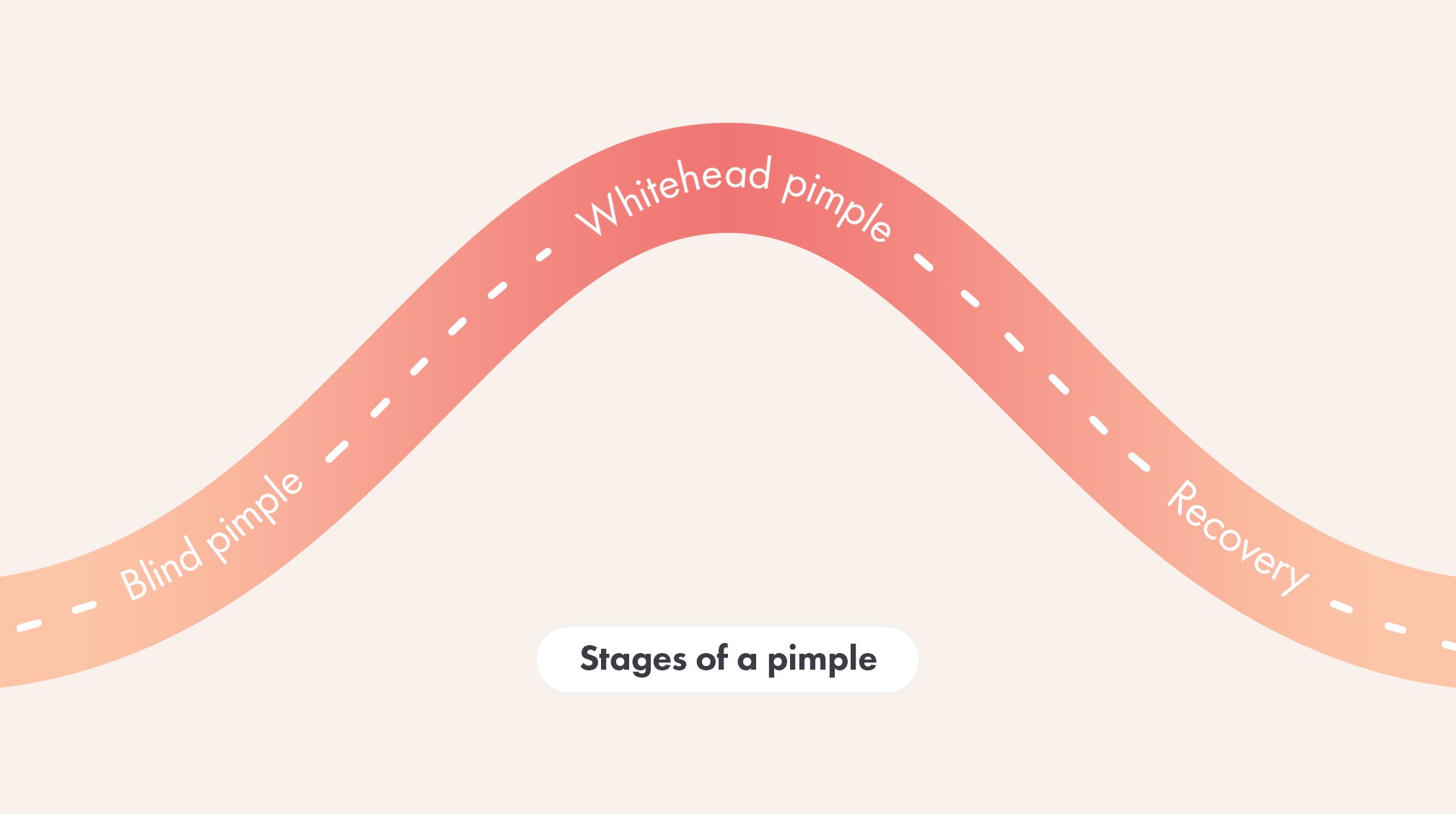 Hero Cosmetics stages of a pimple pimple journey