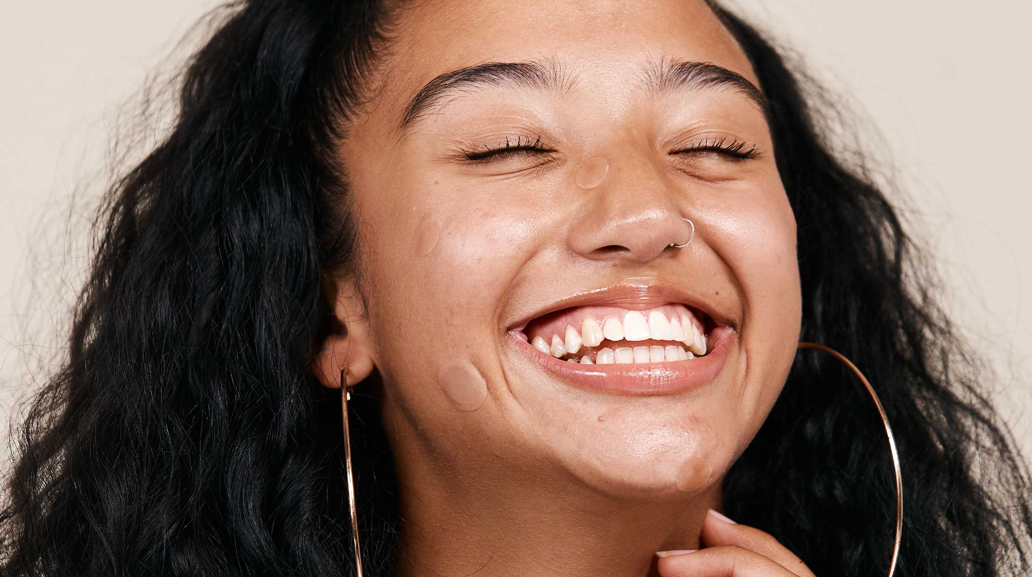 Lady smiles while wearing pimple patches.