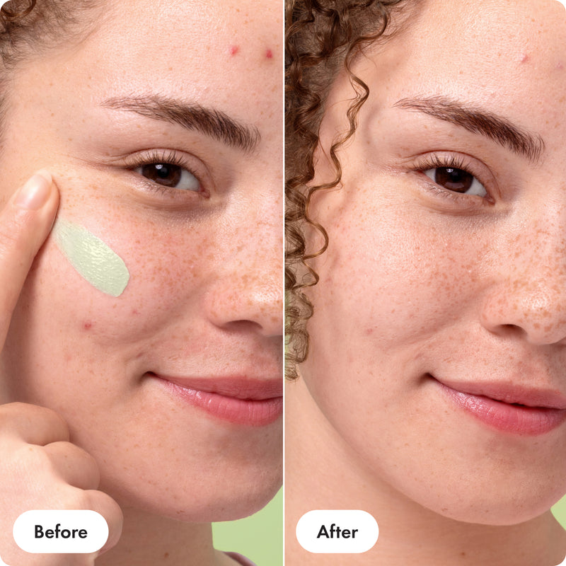 Say goodbye to redness