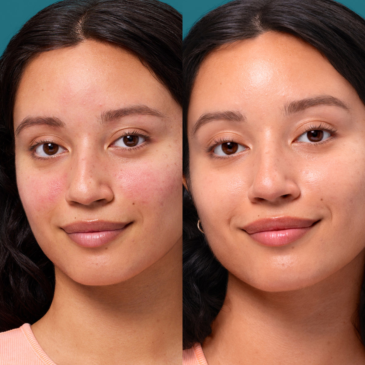 Side by side close up shot of same woman's face showcasing redness correction after using Rescue Balm Red Correct