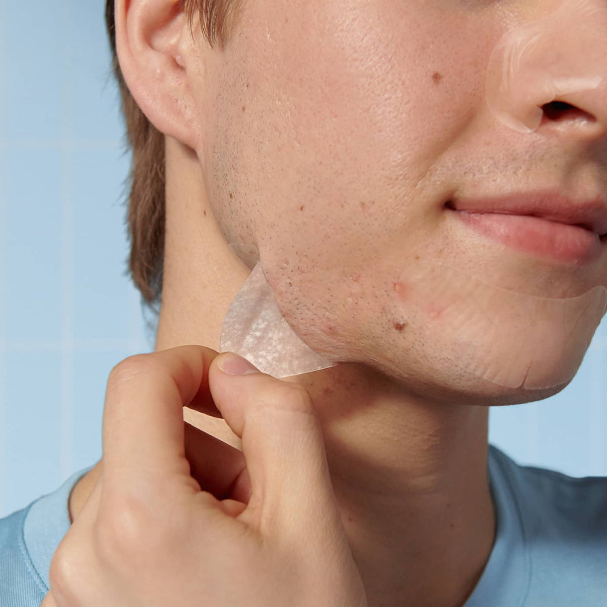 Patch Mask Mighty Patch™ Face - XL Patches for Acne | Hero Cosmetics