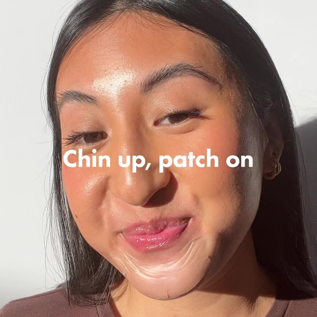 Mighty Patch™ Chin Pimple Patch | Hero Cosmetics