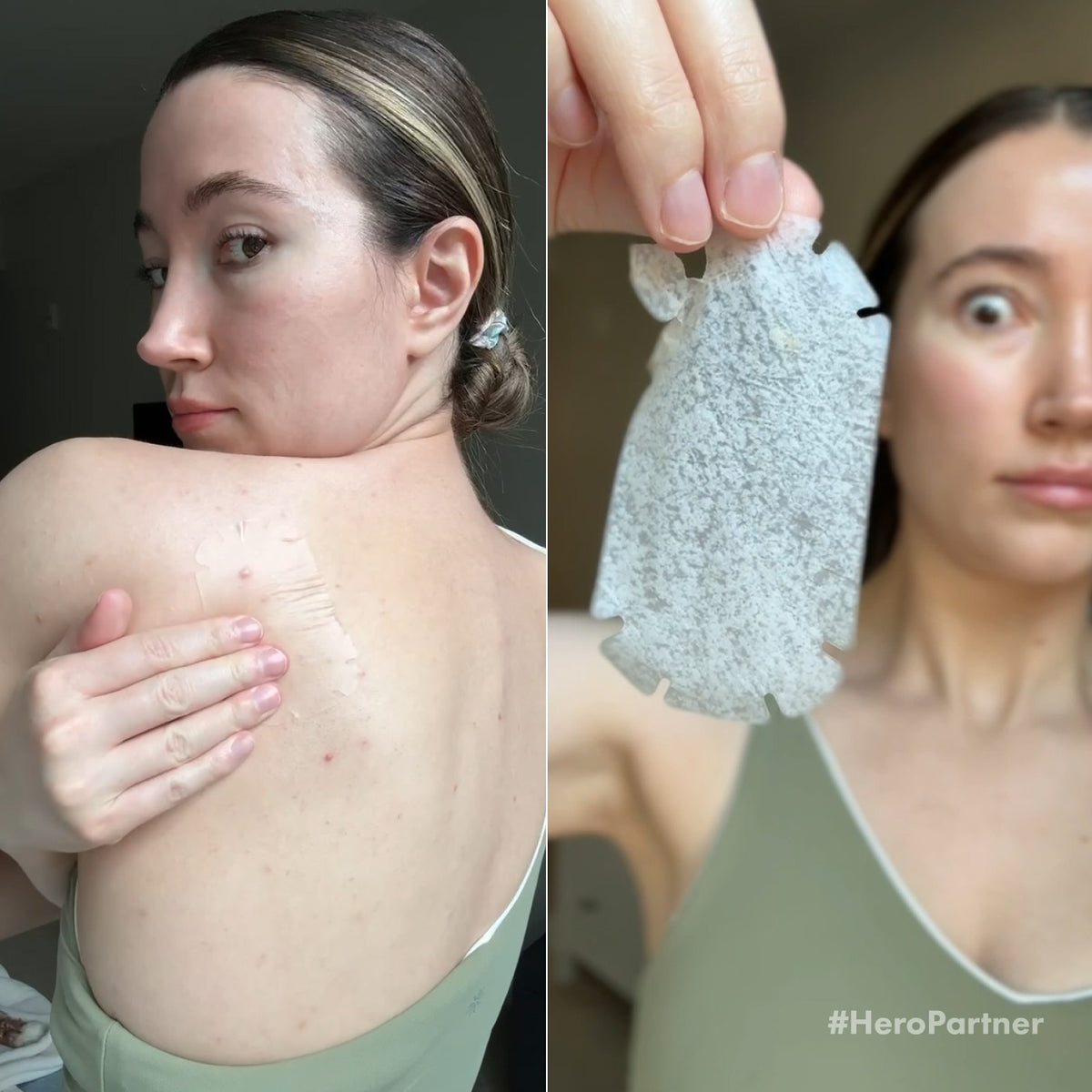 Mighty Patch™ Body patch | Hero Cosmetics