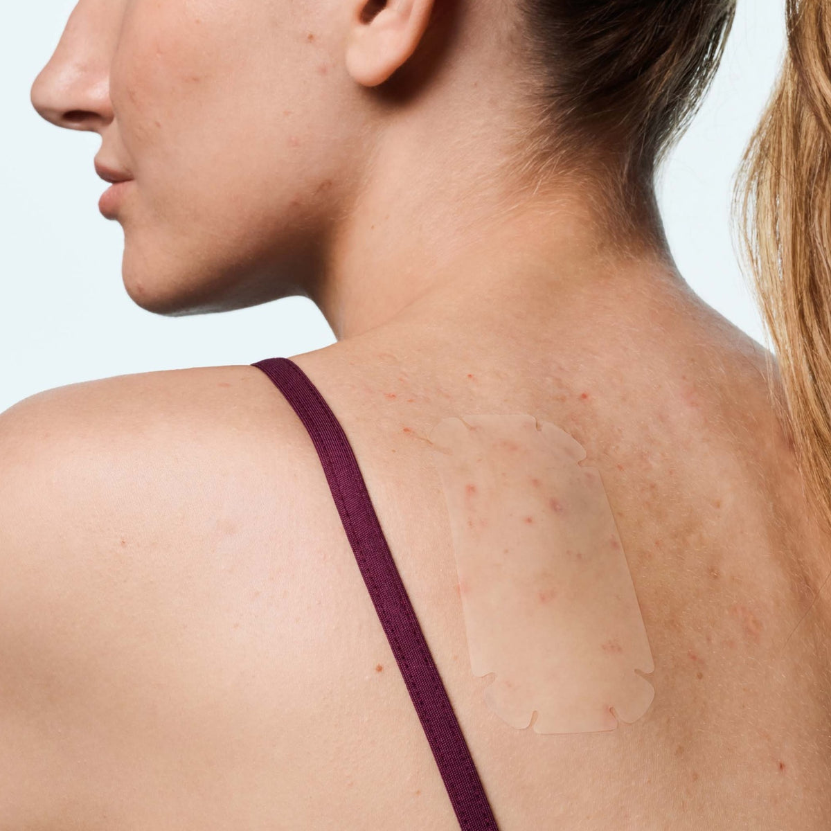 Body Patch Types Mighty Patch™ Body patch | Hero Cosmetics