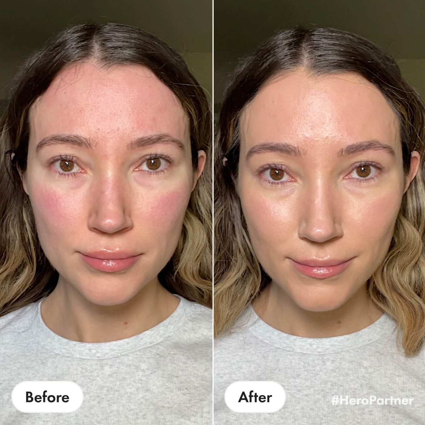 Rescue Balm +Red Correct | 15 ml | Hero Cosmetics