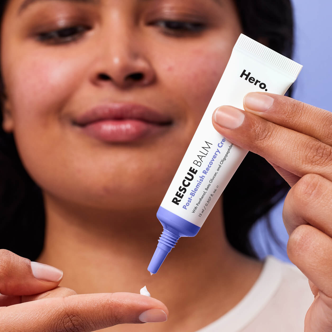 Rescue Balm | The Post-Blemish Recovery Cream | 15 ml | Hero Cosmetics