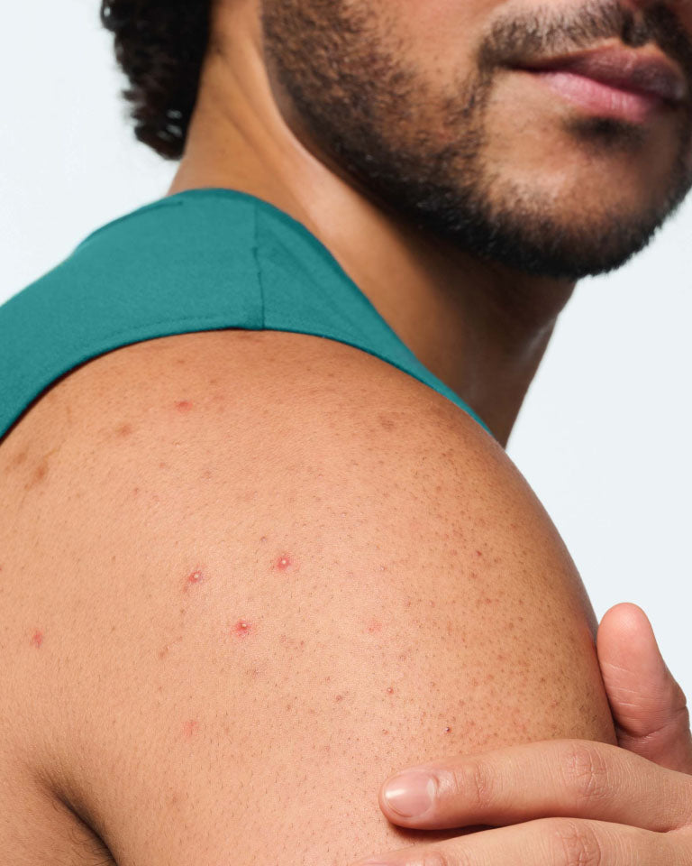 Body Patch Mighty Patch™ Body patch | Hero Cosmetics